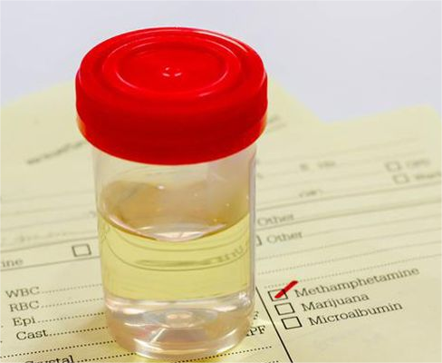 南宁做试管婴儿有年龄限制吗~助孕机构招聘官网