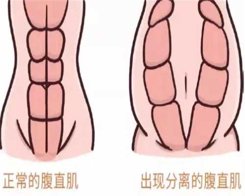 地屈孕酮片有什么功效-地屈孕酮片吃几次几天月经来~代生代怀费用