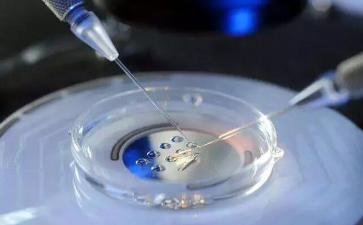 二胎备孕前检查项目~助孕机构咨询电话