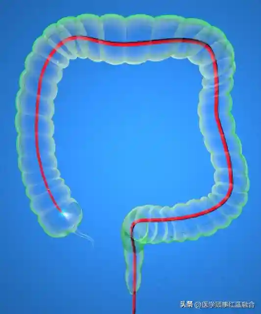 热灭活青春双歧杆菌通过潘氏样细胞介导干细胞活化改善结肠衰老